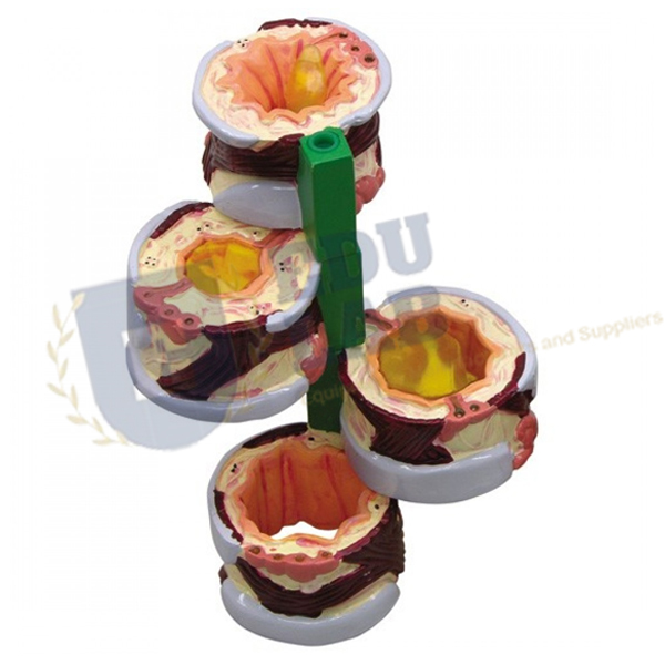 Bronchus Model