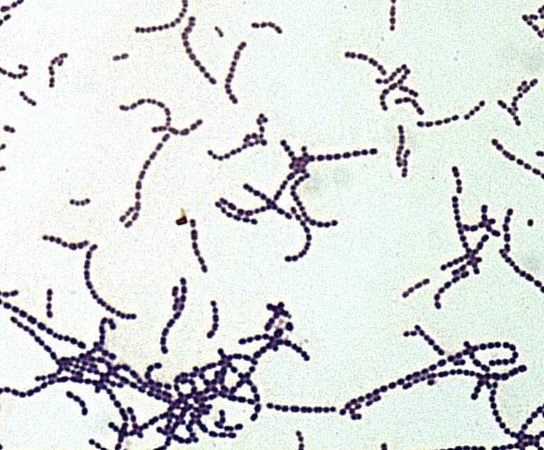 Streptococcus (1000x)