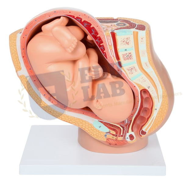 Pregnancy Pelvis With Mature Fetus