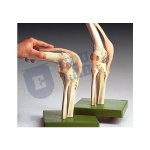 Knee Joint Set