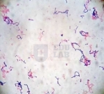 Bacteria (1000x, gram stain)